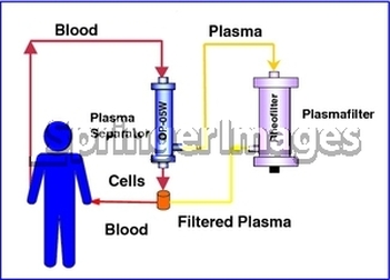 process plasma donation plasmapheresis weebly